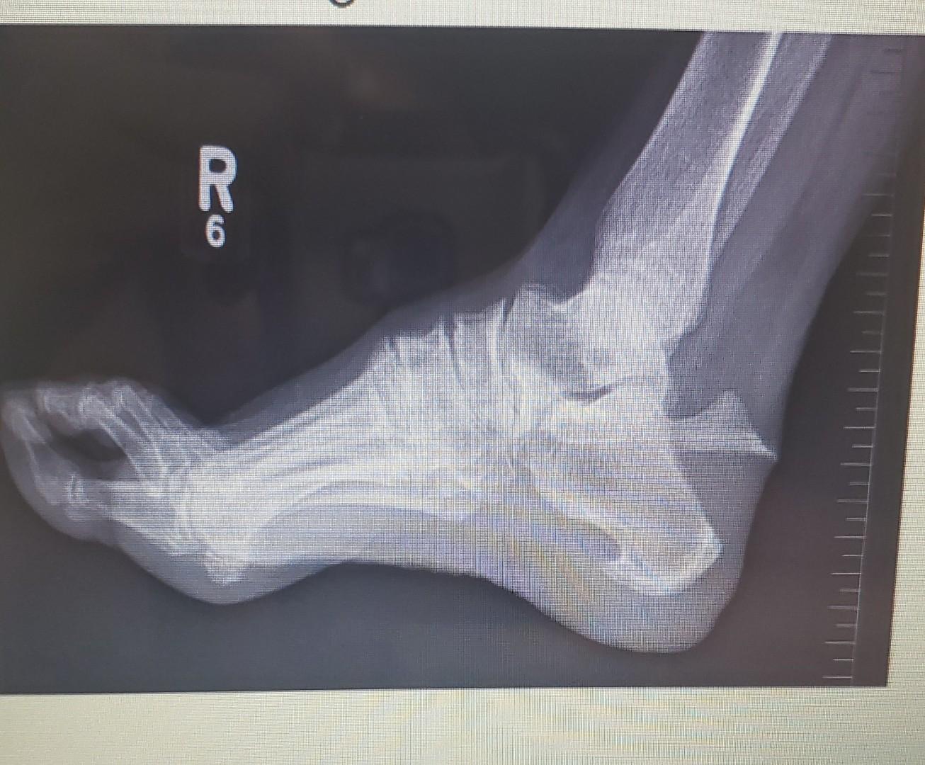 R What Bones Are Present In This X Ray Below Are These Bones In The Axial Or Appendicular Skeleton What Specific Bon 1