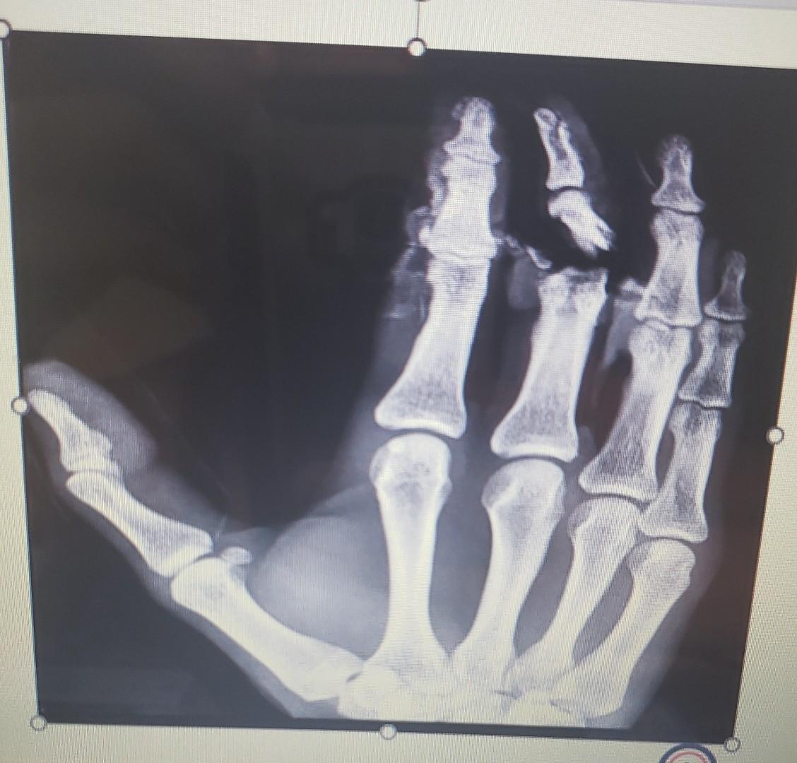 R What Bones Are Present In This X Ray Below Are These Bones In The Axial Or Appendicular Skeleton What Specific Bon 3