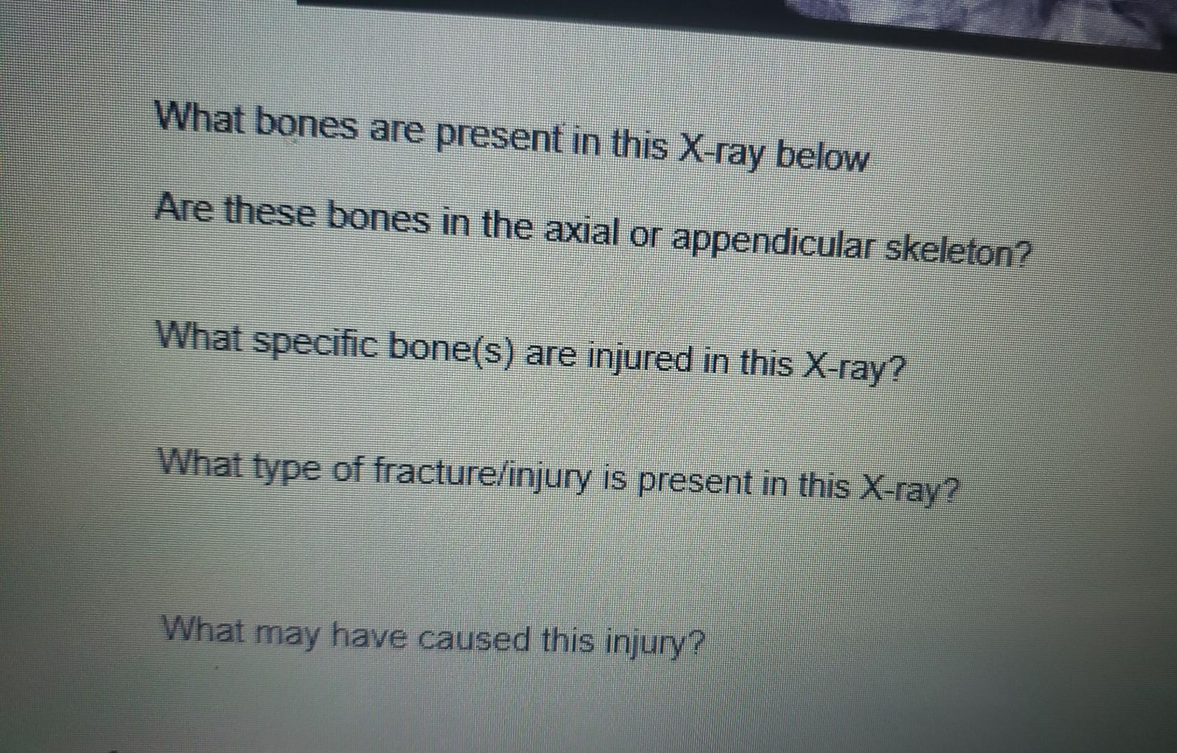 R What Bones Are Present In This X Ray Below Are These Bones In The Axial Or Appendicular Skeleton What Specific Bon 4