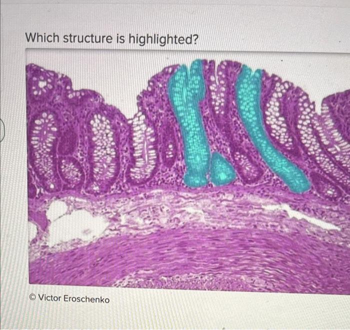 Which Structure Is Highlighted Victor Eroschenko O O O O Muscularis Mucosae Opening Of Intestinal Gland Simple Column 1