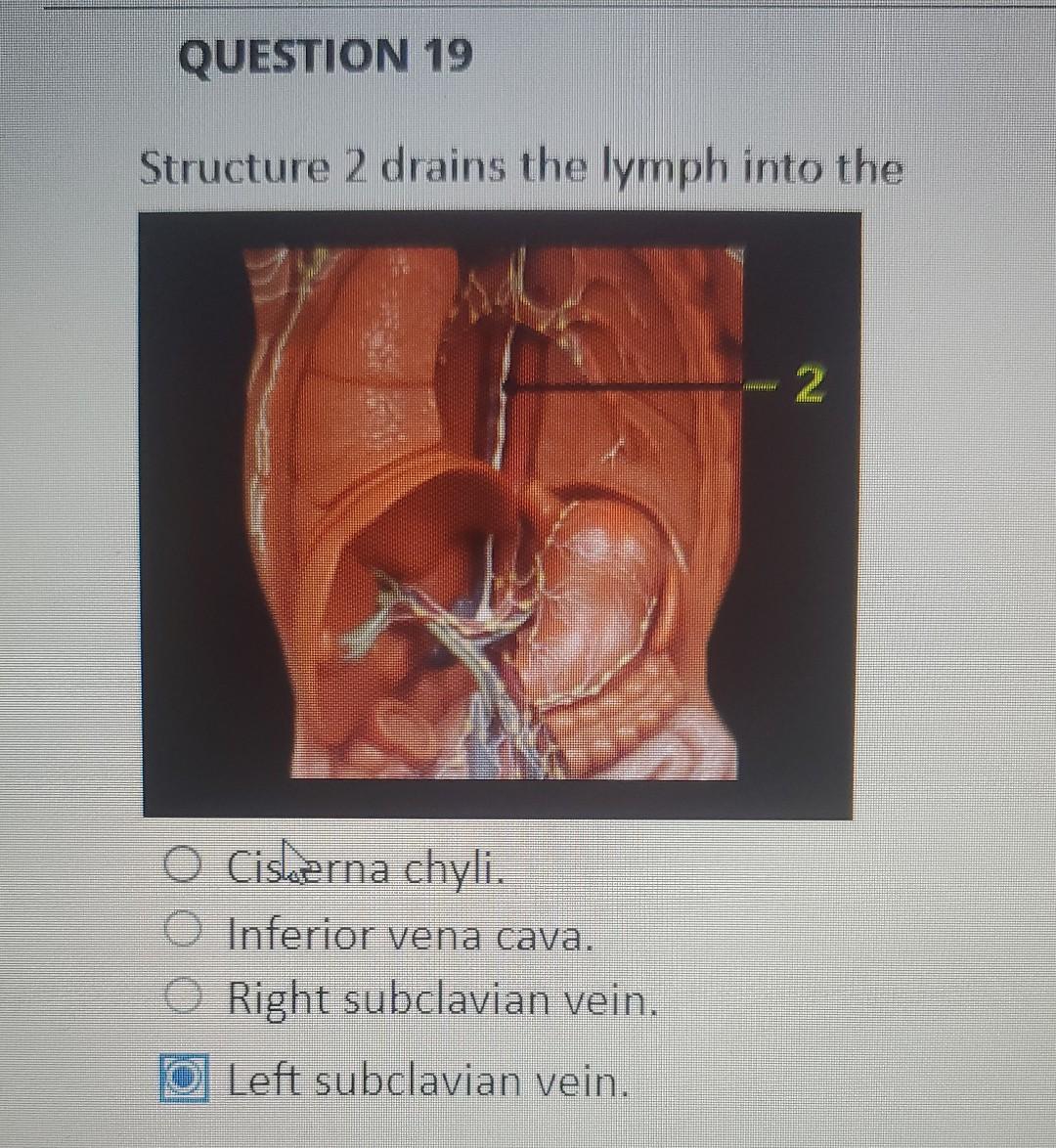 Question 20 Structure 1 Ventilates A 4 O Lung 3 2 1 O Pulmonary Segment O Pulmonary Lobe Pulmonary Lobule Question 2