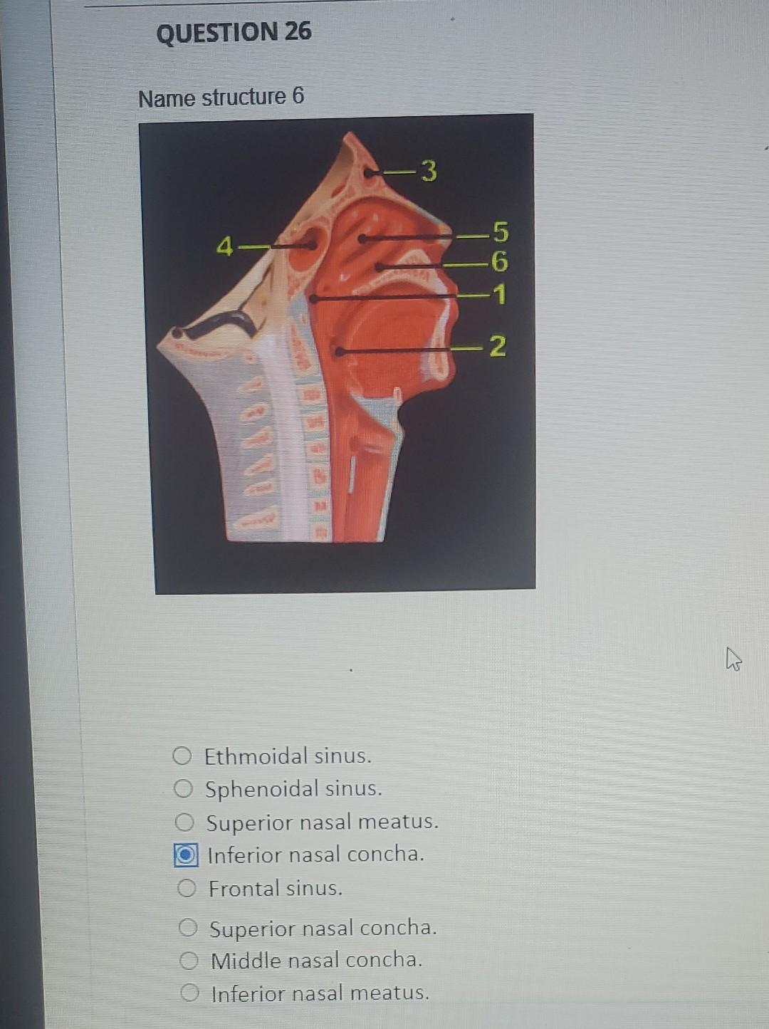Question 26 Name Structure 6 4 3 Ethmoidal Sinus Sphenoidal Sinus Superior Nasal Meatus Inferior Nasal Concha Front 1