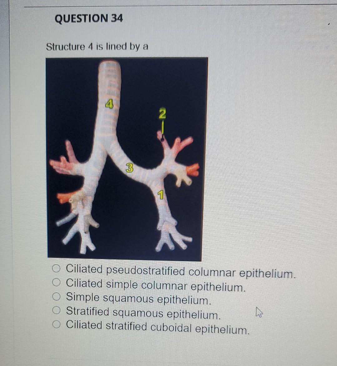 Question 34 Structure 4 Is Lined By A 4 3 Nj 1 Ciliated Pseudostratified Columnar Epithelium Ciliated Simple Columnar E 1