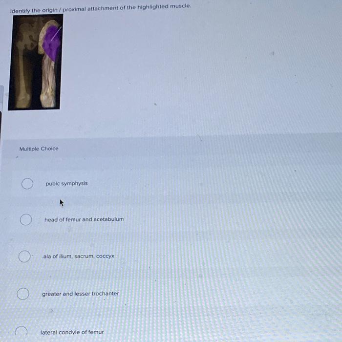 Identify The Origin Proximal Attachment Of The Highlighted Muscle Multiple Choice Pubic Symphysis Head Of Femur And A 1