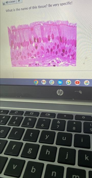 3 4 Listen E What Is The Name Of This Tissue Be Very Specific A 4 R 4 7 6 5 T 6 0 6 E Oll Hp 887 O Y U H J V 1