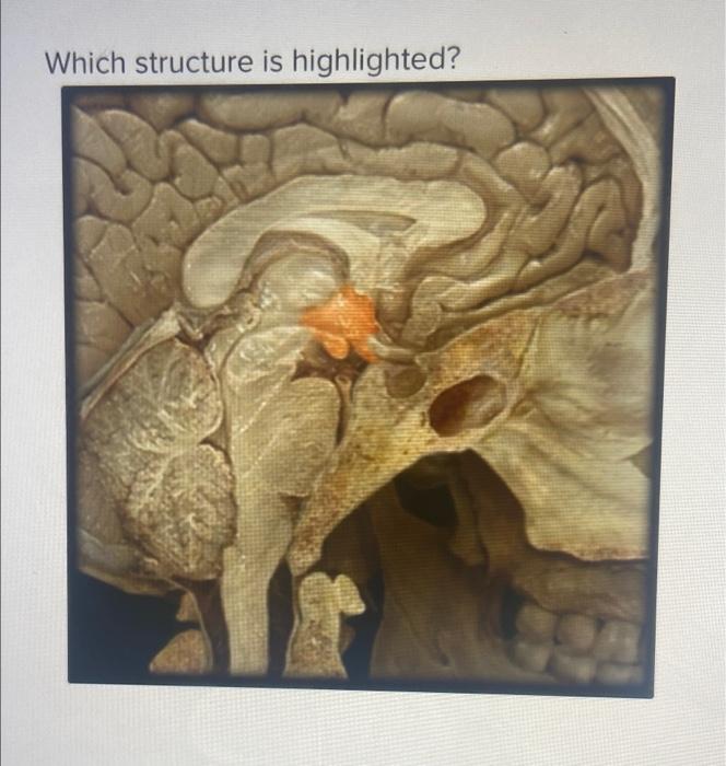 Which Structure Is Highlighted 1 24 Multiple Choice O O O O Hypothalamus Thymus Gland Suprarenal Gland Pituitary Gland 1