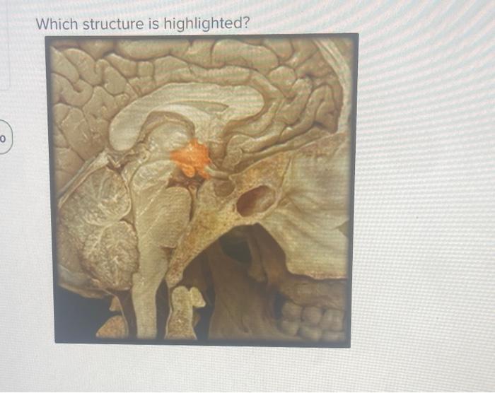 0 Which Structure Is Highlighted 17 20 Multiple Choice O O O O Hypothalamus Thymus Gland Suprarenal Gland Pituitary Gl 1