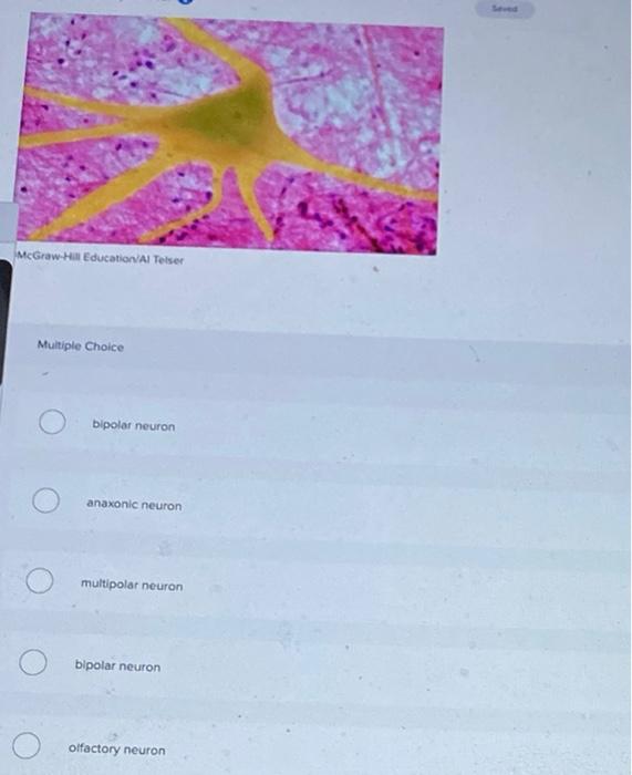 Which Is The Corect Answer For All Questions Below 3