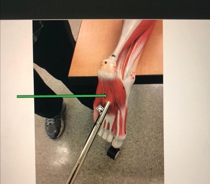 What Is This Muscle On Bottom Foot 1