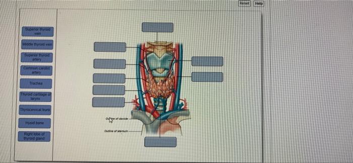 Supenor Thyroid Gira Midde Hyroid Ven Superior Thyroid Artery Common Carotid Artery Trachea Thyroid Cartilage Of Thyroce 1