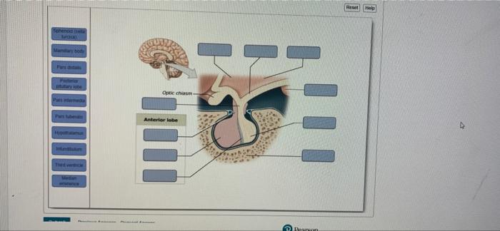 B Sphenoid Suroo Manary Body Pacteria Putury Lone Inthlm That C Medan Mare Optic Chiasm Anterior Lobe Deapon I Reset Hel 1