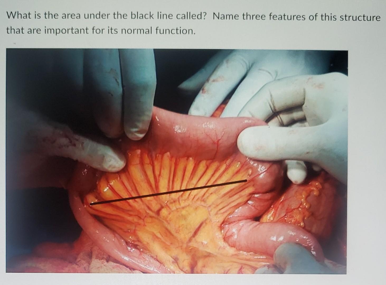 What Is The Area Under The Black Line Called Name Three Features Of This Structure That Are Important For Its Normal Fu 1