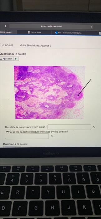 102201 Human Left 0 56 01 Question 6 2 Points 4 Listen Question 7 2 Points 80 E D This Slide Is Made From Which Orga 1