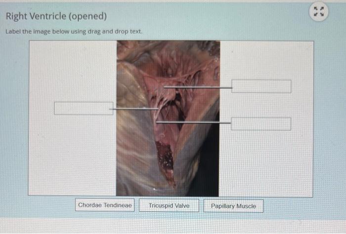 Right Ventricle Opened Label The Image Below Using Drag And Drop Text Chordae Tendineae Tricuspid Valve Papillary Mus 1