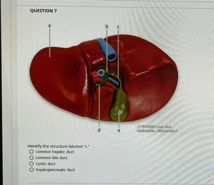 Question 6 Identify The Structure Labeled A Muscularis Externa O Submucosa O Serosa Mucosa Marta Question 7 A Identif 2