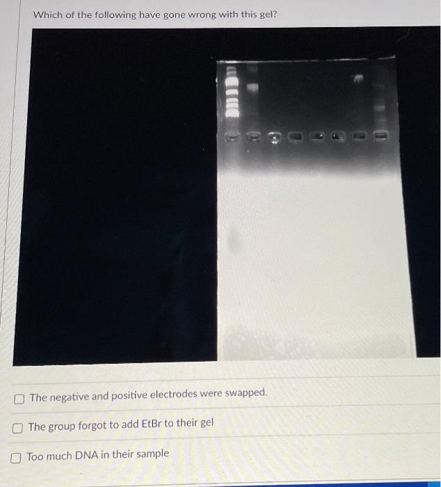Which Of The Following Have Gone Wrong With This Gel The Negative And Positive Electrodes Were Swapped The Group Forgo 1