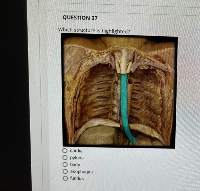 Question 37 Which Structure Is Highlighted Cardia Pyloris Body Esophagus Fundus Question 41 Which Structure Is Highlig 1