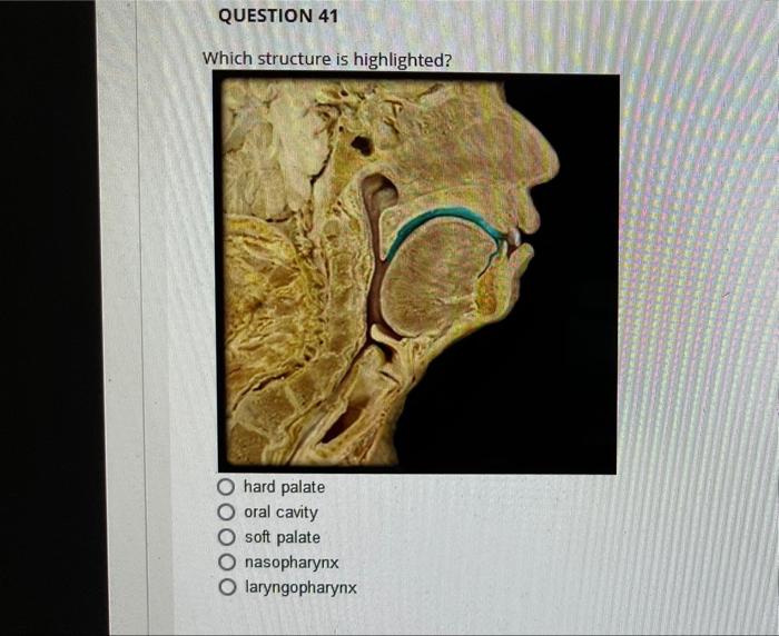 Question 37 Which Structure Is Highlighted Cardia Pyloris Body Esophagus Fundus Question 41 Which Structure Is Highlig 2