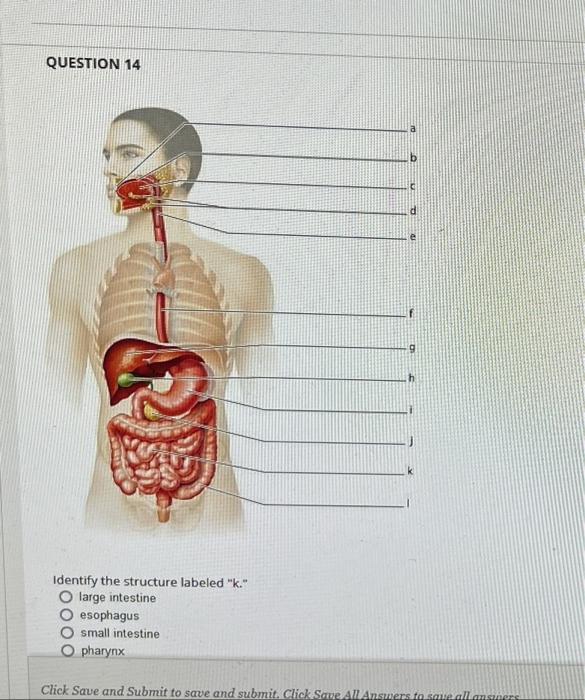 Question 37 Which Structure Is Highlighted Cardia Pyloris Body Esophagus Fundus Question 41 Which Structure Is Highlig 3