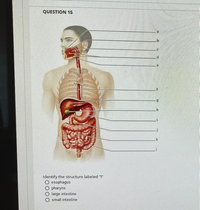 Question 37 Which Structure Is Highlighted Cardia Pyloris Body Esophagus Fundus Question 41 Which Structure Is Highlig 4