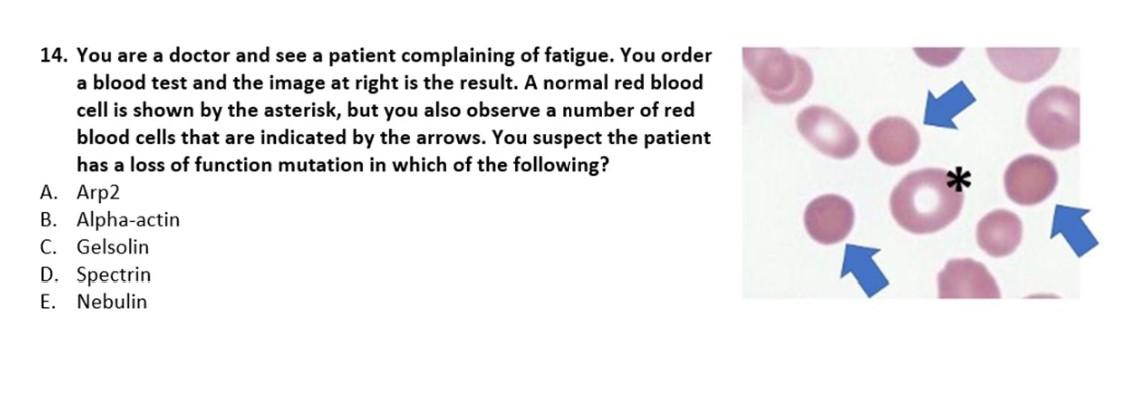 14 You Are A Doctor And See A Patient Complaining Of Fatigue You Order A Blood Test And The Image At Right Is The Resu 1