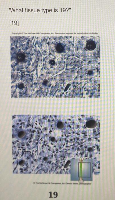 What Tissue Type Is 19 19 Copyright The 19 What Tissue Type Is 21 21 Copyright The Mec H Compare Inc Ani 1