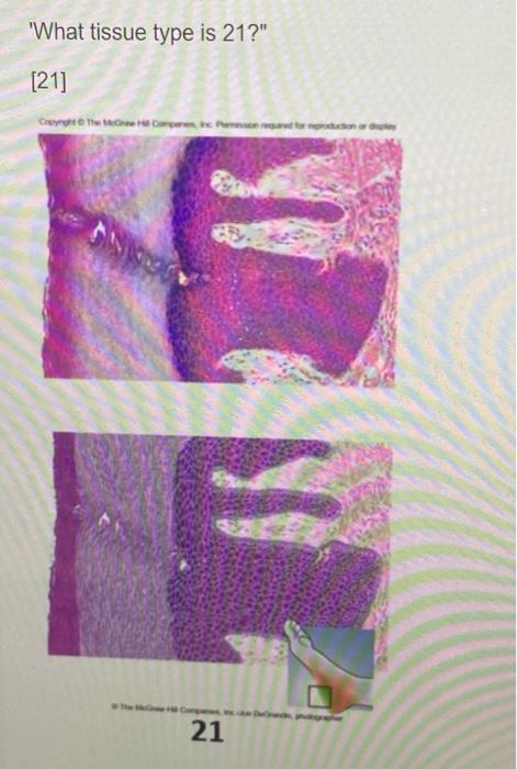 What Tissue Type Is 19 19 Copyright The 19 What Tissue Type Is 21 21 Copyright The Mec H Compare Inc Ani 2