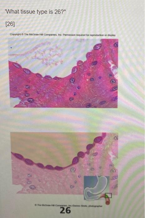 What Tissue Type Is 19 19 Copyright The 19 What Tissue Type Is 21 21 Copyright The Mec H Compare Inc Ani 3