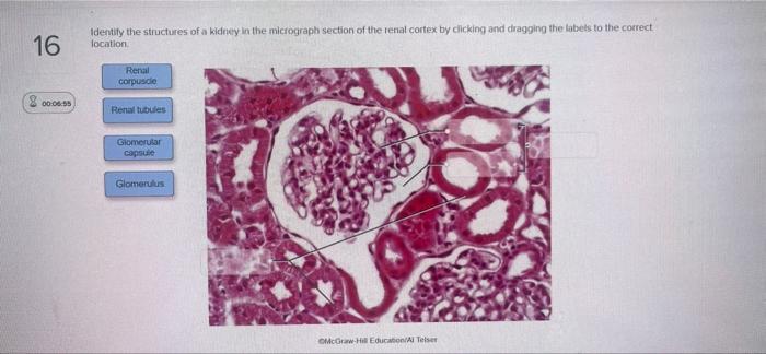 16 00 06 55 Identify The Structures Of A Kidney In The Micrograph Section Of The Renal Cortex By Clicking And Dragging T 1