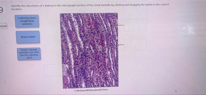 9 02 25 Identify The Structures Of A Kidney In The Micrograph Section Of The Renal Medulla By Clicking And Dragging The 1