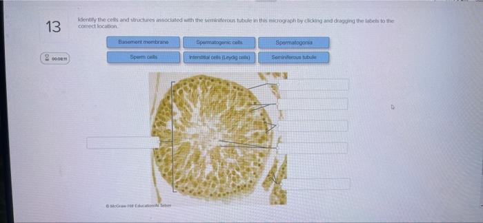 13 2000m Identify The Cells And Structures Associated With The Seminiferous Tubule In This Micrograph By Clicking And Dr 1