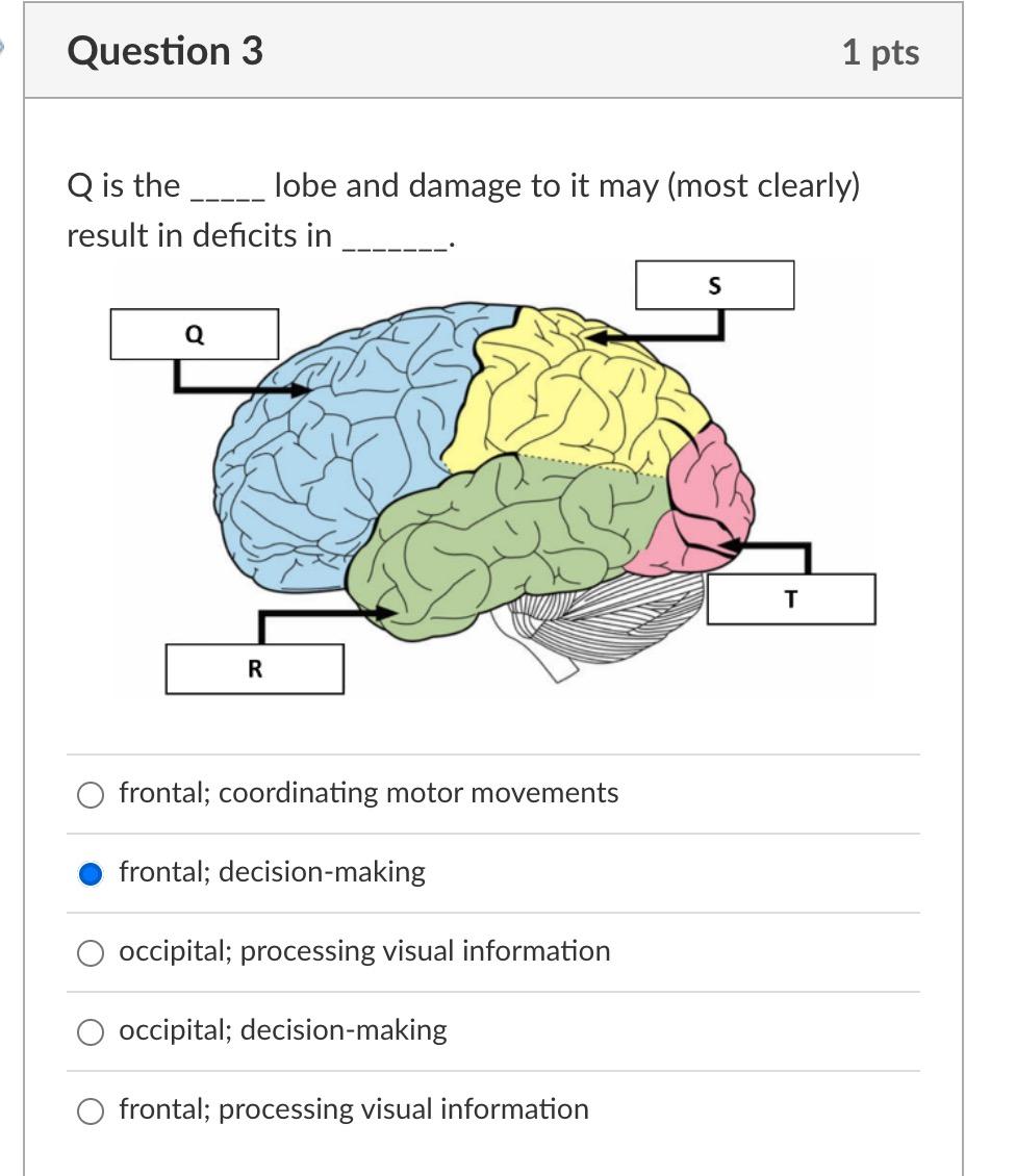Question 3 Q Is The Result In Deficits In Q R Lobe And Damage To It May Most Clearly Frontal Coordinating Motor Movem 1