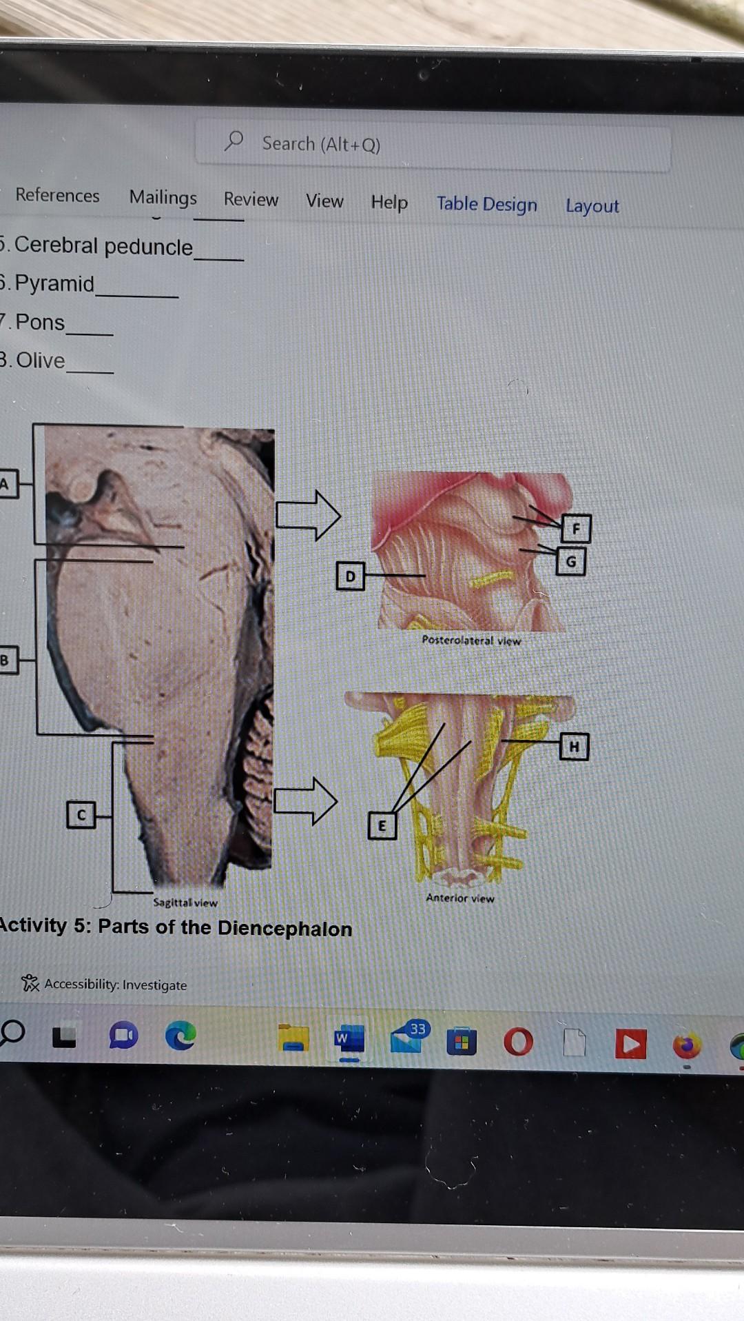 Identify The Parts Of The Brainstem A H Each Letter Will Only Be Used On 21 Superior Colliculus 22 Midbrain Diction 2