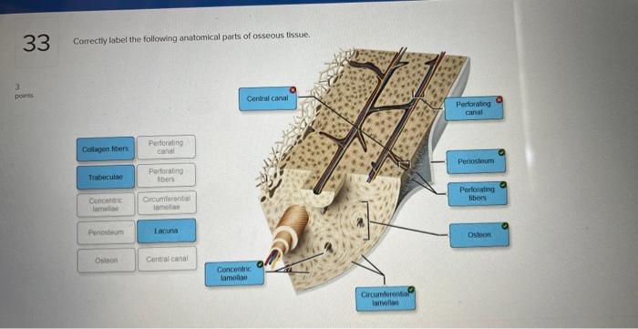 33 Correctly Label The Following Anatomical Parts Of Osseous Tissue 3 Points Collagen Fibers Trabeculse Concentric Lame 1