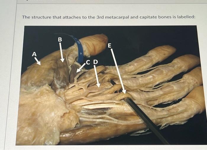 The Structure That Attaches To The 3rd Metacarpal And Capitate Bones Is Labelled B C D E 1