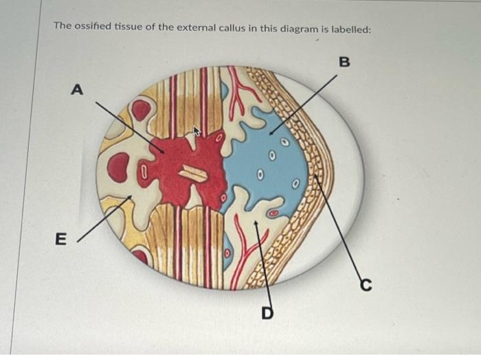 The Ossified Tissue Of The External Callus In This Diagram Is Labelled E A 0 D B 1