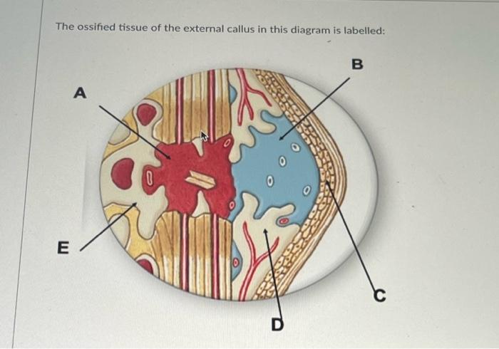 The Ossified Tissue Of The External Callus In This Diagram Is Labelled E A 0 D B 1