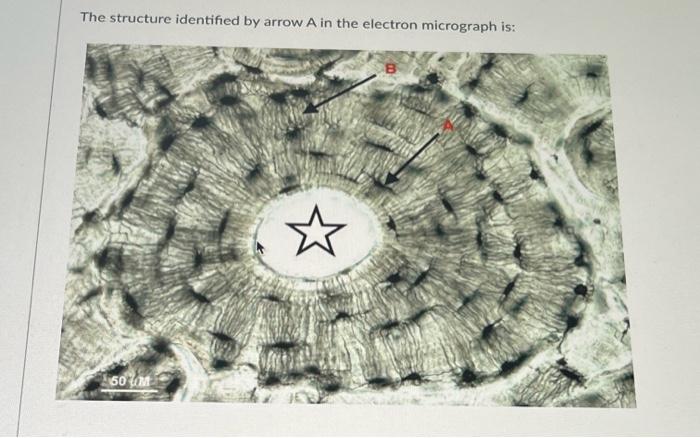 The Structure Identified By Arrow A In The Electron Micrograph Is 60m 1
