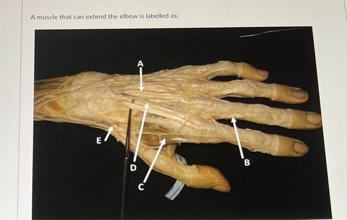 A Muscle That Can Extend The Elbow Is Labelled As E D B 1