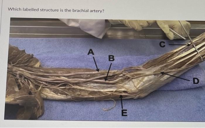 Which Labelled Structure Is The Brachial Artery A B E C D 1