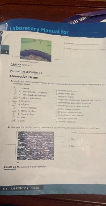 Laboratory Manual For 118 Figure 48 Continued Post Lab Assessment 48 Connective Tissue 1 Match Each Type Of Connective 1