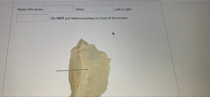 Name This Bone Left Or Right Do Not Put Letters Numbers In Front Of The Answer View 1