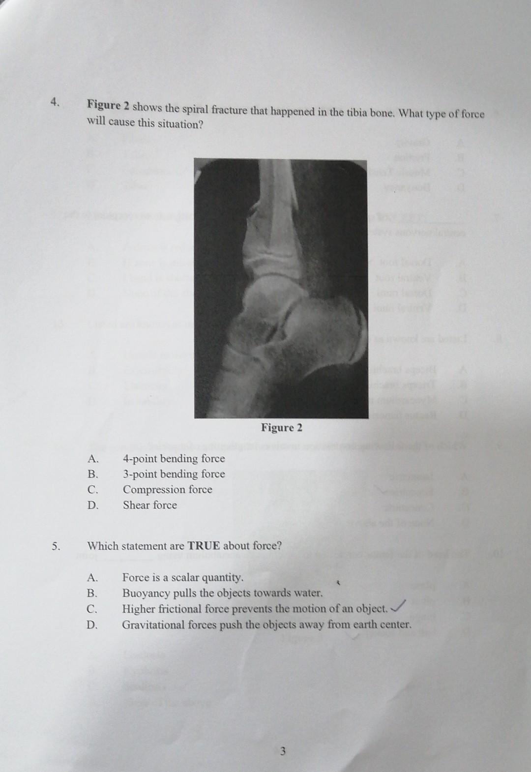 1 2 3 Deformation Can Be Caused By The Involvement Of Listed Force Except A B C D The Production Of Fracture Du 2