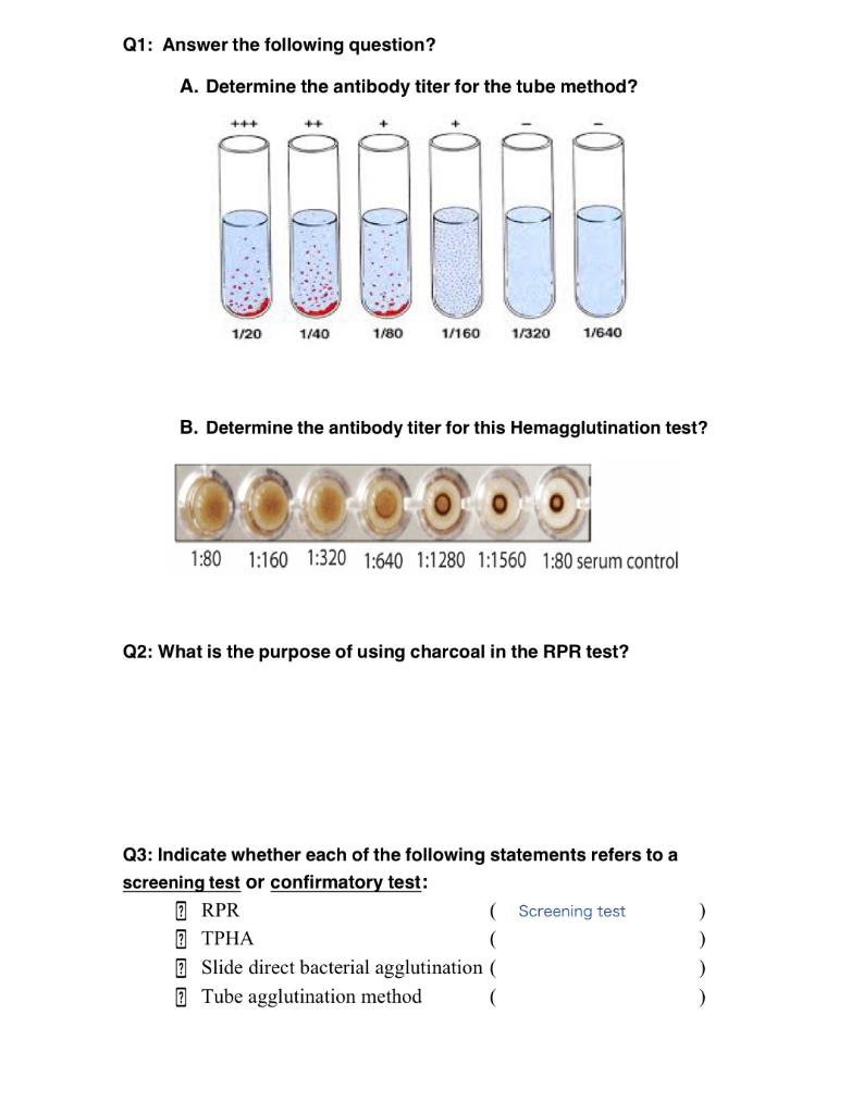 Q1 Answer The Following Question A Determine The Antibody Titer For The Tube Method Ut 1 20 1 40 1 80 1 160 1 32 1