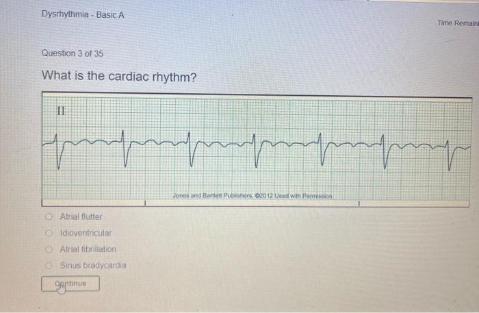 Dysrhythmia Basic A Time Remain Question 3 Of 35 What Is The Cardiac Rhythm Il Gepreprehmomme Jones And Bartlett Pubs 1