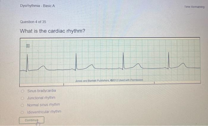 Dysrhythmia Basic A Time Remaining Question 4 Of 35 What Is The Cardiac Rhythm 1 Jonod And Bartlett Pc2012 Used With 1