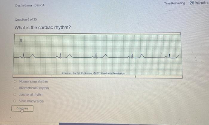 Dysthythmia Basic A Time Remaining 26 Minutes Question 6 Of 35 What Is The Cardiac Rhythm Ii W Ua Wa In Jobp 0 012 Uu 1