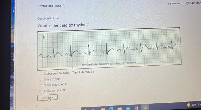 Time Remaning 24 Minutes Dysthythmia Basic A Question 9 Of 35 What Is The Cardiac Rhythm Til 1 Whichchhuhhhhhh Cand L 1