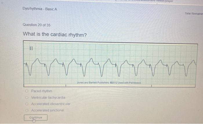 Dysthythmia Basic A Question 10 Of 35 What Is The Cardiac Rhythm Ii Nam Unmur Bp00012 Accelerated Idioventricular Fin 3