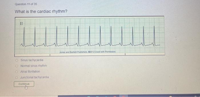 Dysthythmia Basic A Question 10 Of 35 What Is The Cardiac Rhythm Ii Nam Unmur Bp00012 Accelerated Idioventricular Fin 4